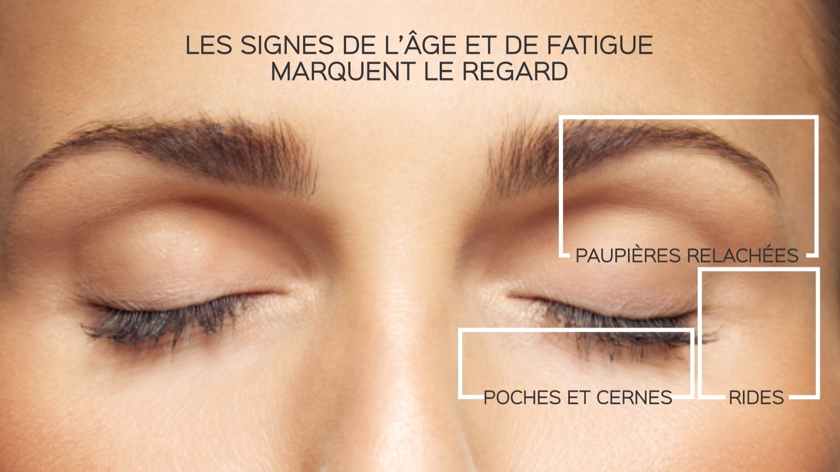 Vidéo del Tratamiento Eye Lift